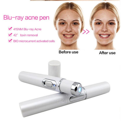 Blue Light Therapy Acne Laser Pen Soft Scar Wrinkle Removal Treatment Device