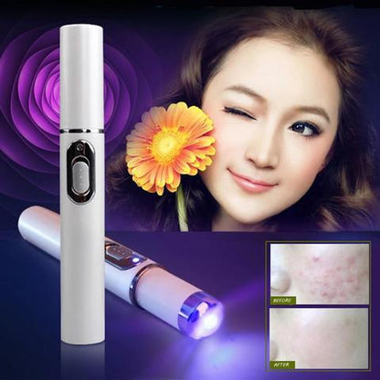 Blue Light Therapy Acne Laser Pen Soft Scar Wrinkle Removal Treatment Device